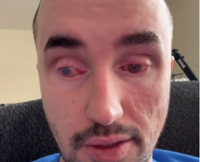 Help Robert afford scleral lenses and eye surgery