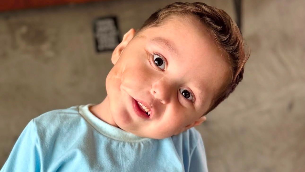 Ayúdanos a salvar la carita de Bruno