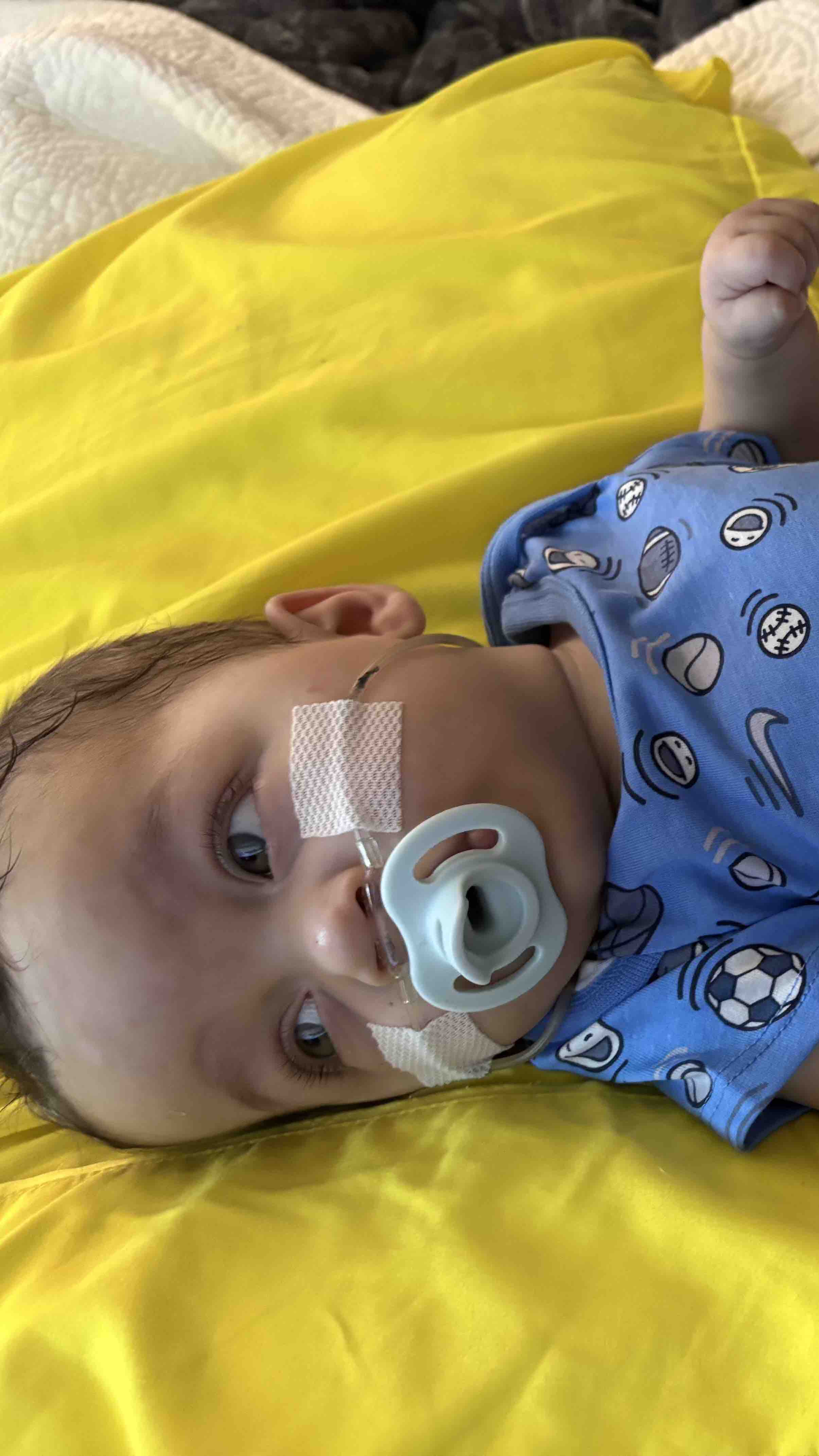 Help baby Liam fight lifelong medical issues!